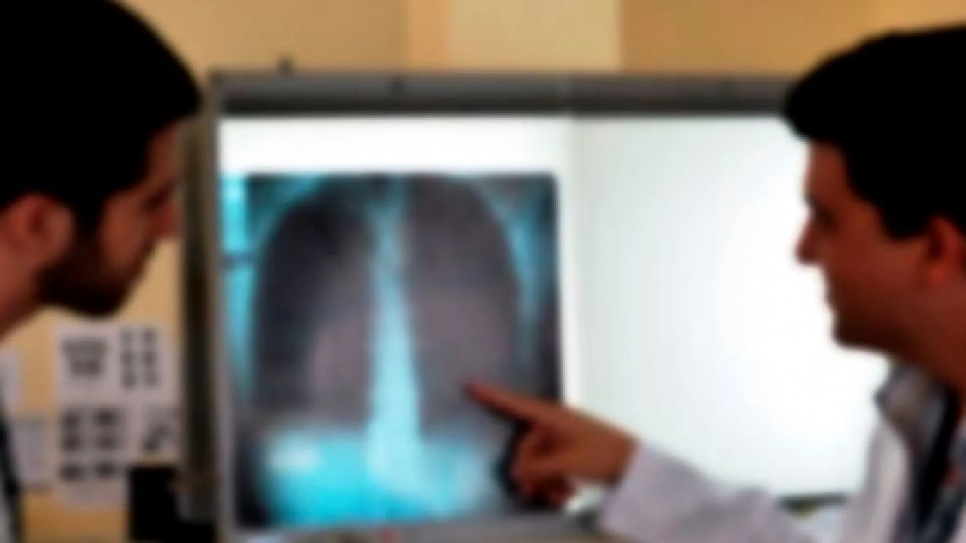 Foto de um residente acompanhado por um médico avaliando um exame de imagem